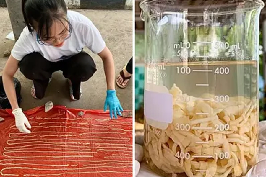 मान्छेको पेटभित्र भेटियो ५९ फुटको जुका