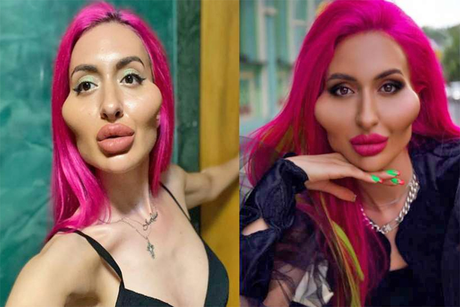 यी हुन् संसारकै ठूलो गाला भएकी मोडल