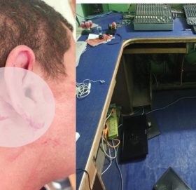 कैलालीको रेड स्टार एफएफमा तोडफोड, प्रबन्ध निर्देशक जैशीमाथि कुटपिट