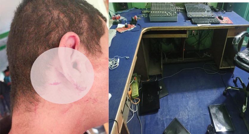 कैलालीको रेड स्टार एफएफमा तोडफोड, प्रबन्ध निर्देशक जैशीमाथि कुटपिट