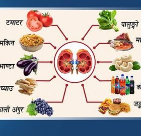 मृगौलाको पत्थरी हुँदा के के नखाने ?