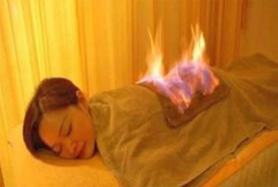 जहाँ औषधिले होइन शरीरमा आगो लगाएर गरिन्छ उपचार !