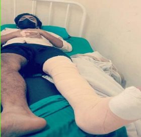 पत्रकार कबराजन पटेलको स्थिति बुझ्न् नेता साहले नेपाल नेसनल अस्पतालमा