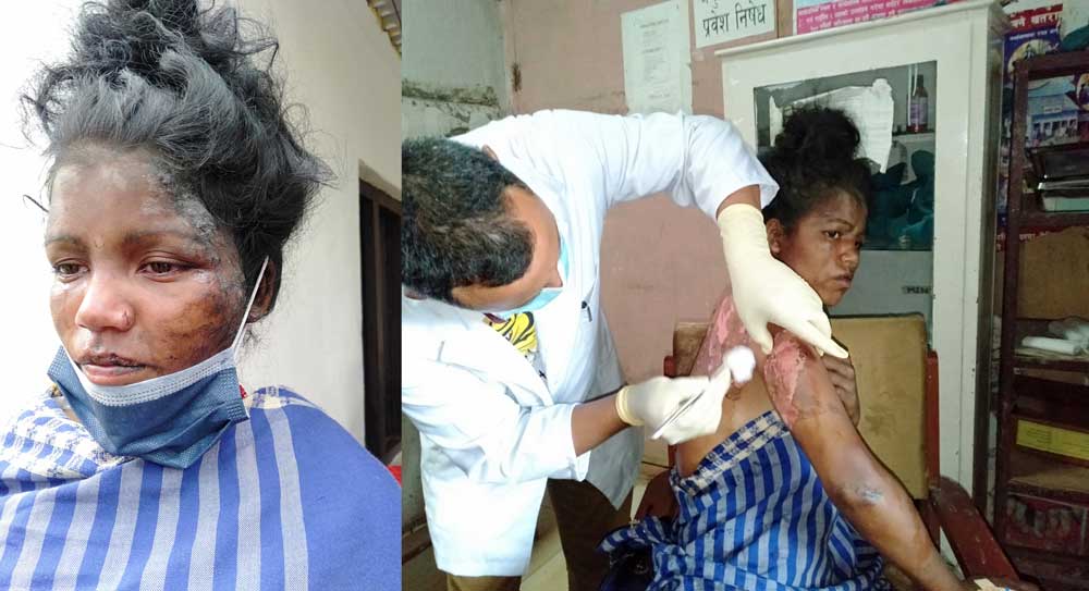 देउता चढेको निहुँमा सुत्केरी पत्नीमाथि क्रुर यातना