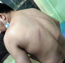 प्रहरीको लाठी चार्जबाट घाइते बाजुराका विद्यार्थी नेता नरेशकाे फोटो सामाजिक सञ्जालमा छ्यापछ्याप्ती