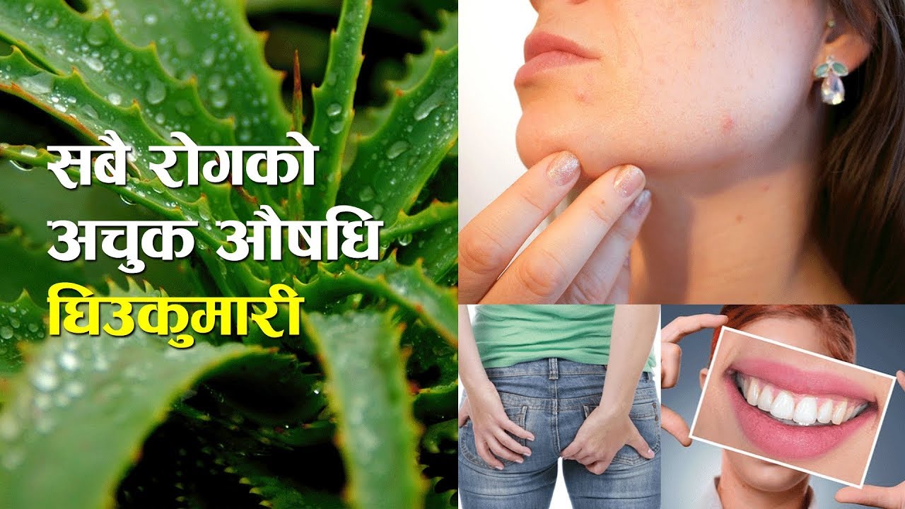 घिउकुमारीको ७ वटा फाइदा र प्रयोग