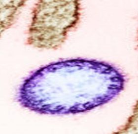 निपा भाइरस संक्रमणबाट कसरी जोगिने ?