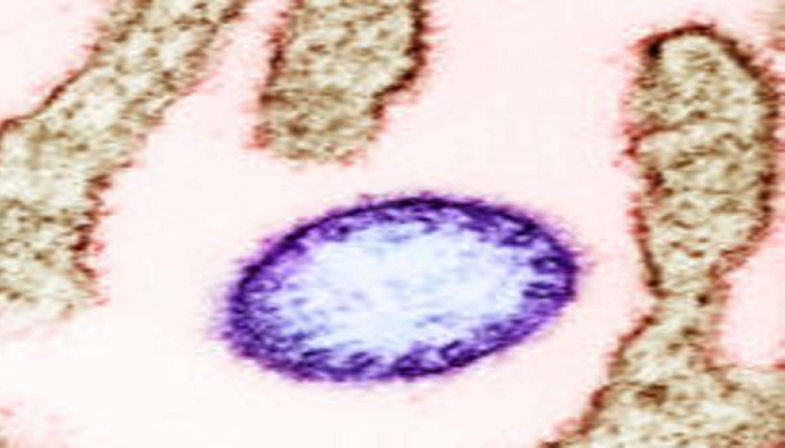 निपा भाइरस संक्रमणबाट कसरी जोगिने ?