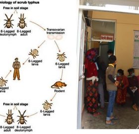 बाजुरामा स्क्रब टाइफस रोगको संक्रमण