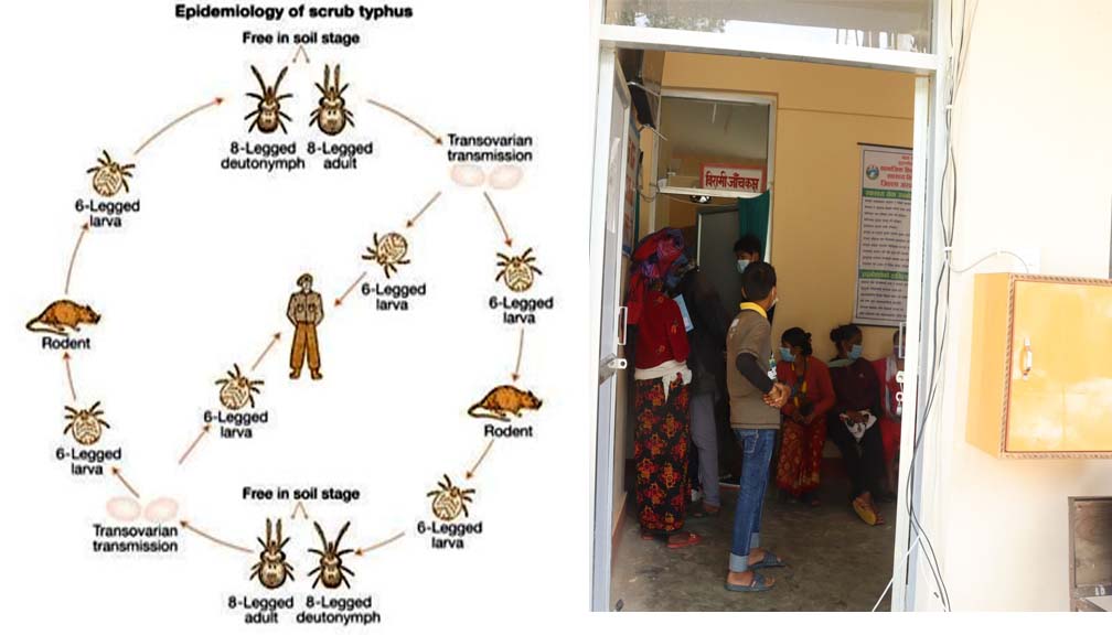 बाजुरामा स्क्रब टाइफस रोगको संक्रमण