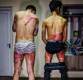 महिला अधिकारवादीको समाचार सम्प्रेषण गर्दा पत्रकारलाई कुटेपछि…