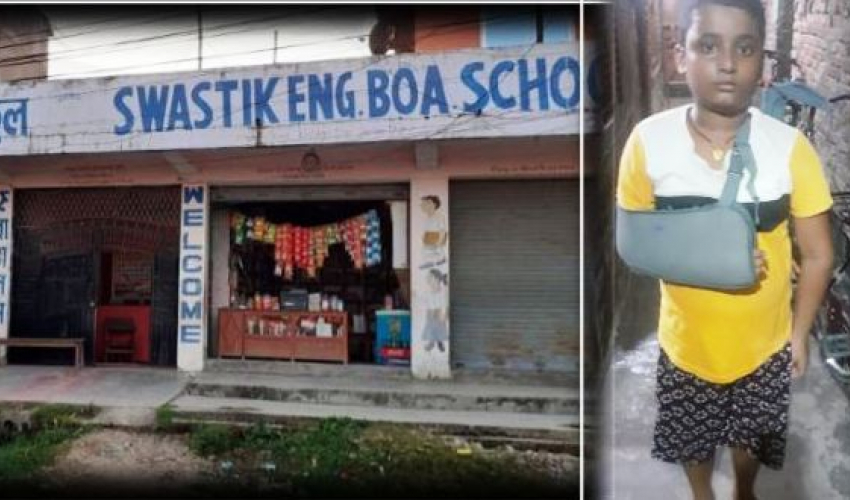 शिक्षकले बिजुलीको वायरिङ गर्ने पाइपले कुटेर विद्यार्थीको हातै भाँचेपछि…