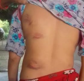 मानव सेवा आश्रममा रहेकी महिलामाथि निर्घात कुटपिट, प्रहरीले लिएन उजुरी