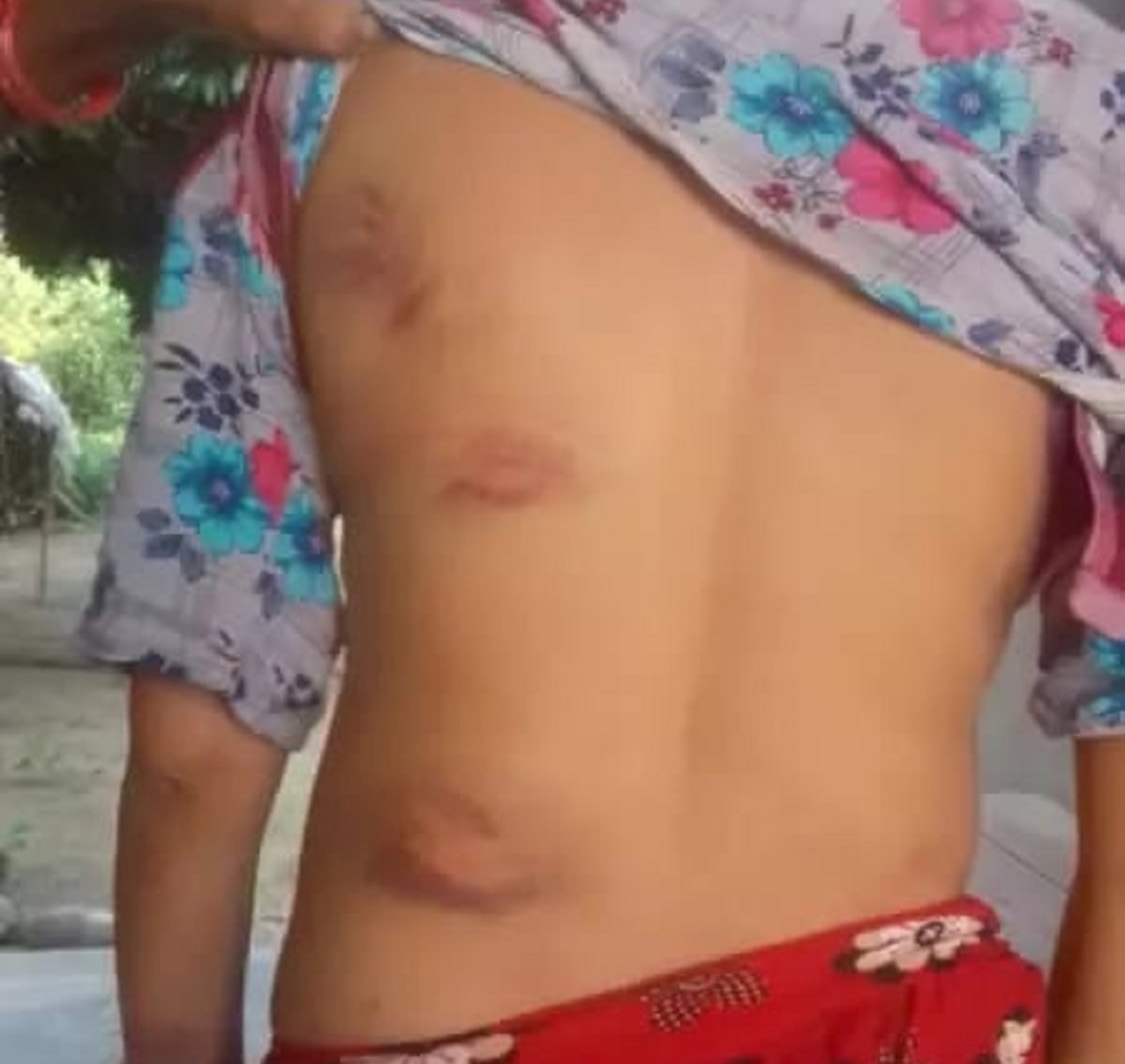 मानव सेवा आश्रममा रहेकी महिलामाथि निर्घात कुटपिट, प्रहरीले लिएन उजुरी