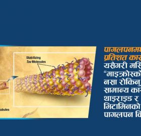 के छ उच्च रक्तचाप, अल्जाइमर र पागलपनको सम्बन्ध !