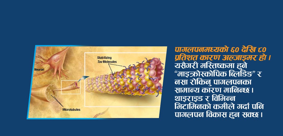 के छ उच्च रक्तचाप, अल्जाइमर र पागलपनको सम्बन्ध !