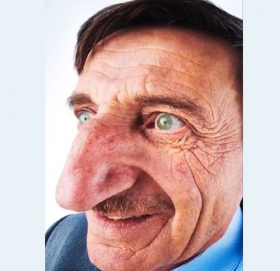 लगातार बढ्दैछ यी व्यक्तिको नाक, गिनिज बुकमा नाम लेखियो