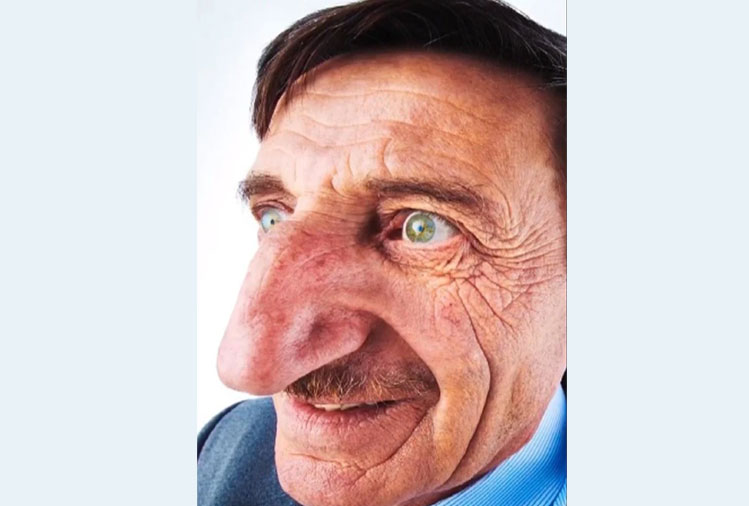 लगातार बढ्दैछ यी व्यक्तिको नाक, गिनिज बुकमा नाम लेखियो