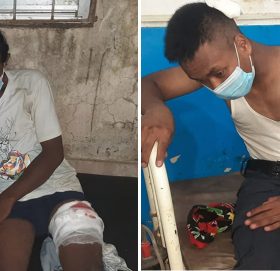 बुटवलमा सुकुम्बासी र प्रहरीबीचको झडपमा ३ जनाको मृत्‍यु, १० भन्दा धेरै घाइते