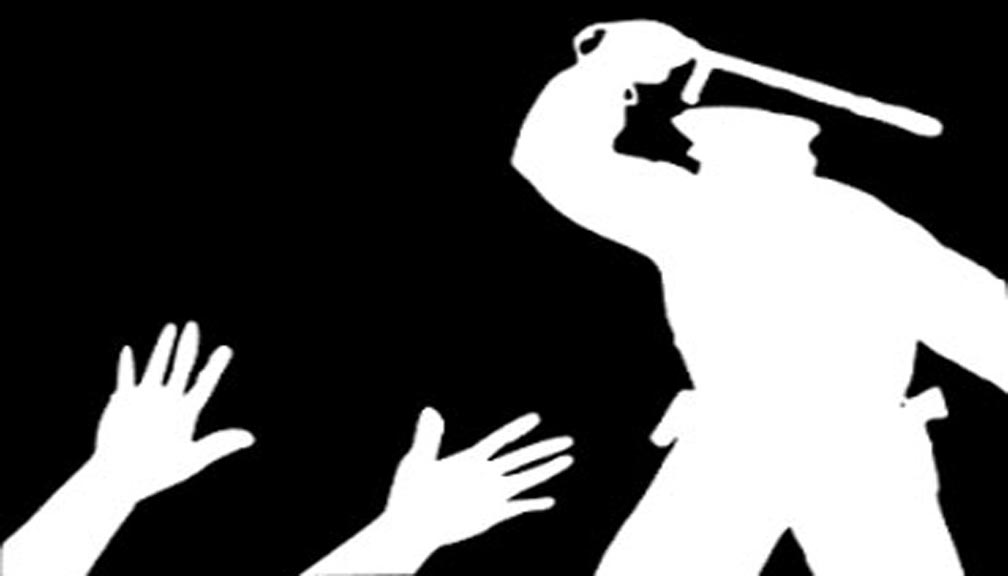 काँग्रेस कार्यक्रता र प्रहरी बिच झडप, दर्जन बढि घाइते मार्तडी बजार तनावग्रस्त