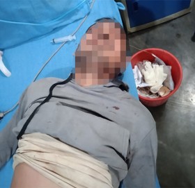 उपचार गराइरहेका बिरामीद्वारा अस्पतालबाट हामफालेर आत्महत्याको प्रयास