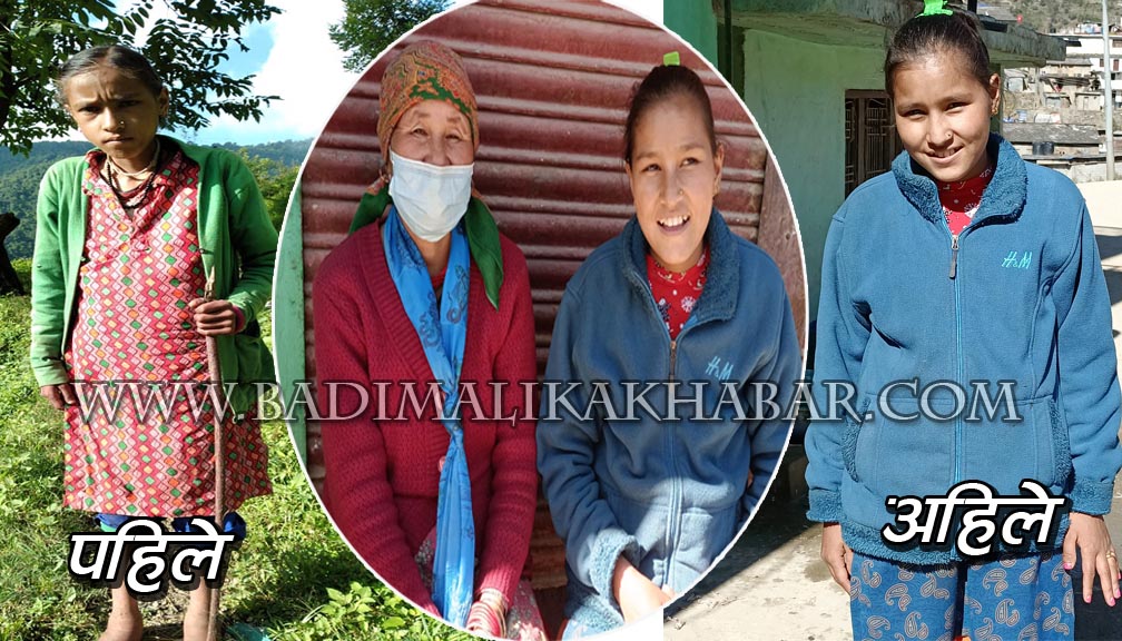 मृत्युको मुखमा पुगेकी मनाकाेटकी क्रान्ति सञ्चो भएर घर फर्किन