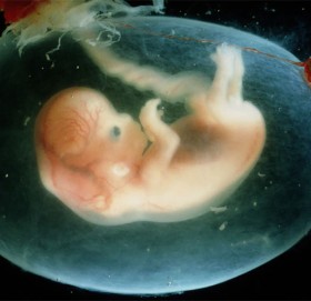 गर्भ रहेको ३५ वर्षसम्म महिलाको पेटमा ७ महिनाको बच्चा !