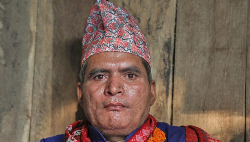 विनाकसुर जेल कुरेका दुर्गाप्रसादलाई भारु ५ लाख क्षतिपूर्ति दिन उच्च अदातलकाे आदेश