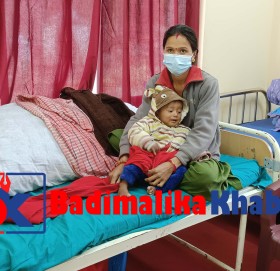 बाजुरामा पहिलो पटक कडा कुपोषित बच्चाको उपचार