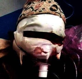 बडिमालिका ९ का बल दमाई उपचार अभावमा अलपत्र