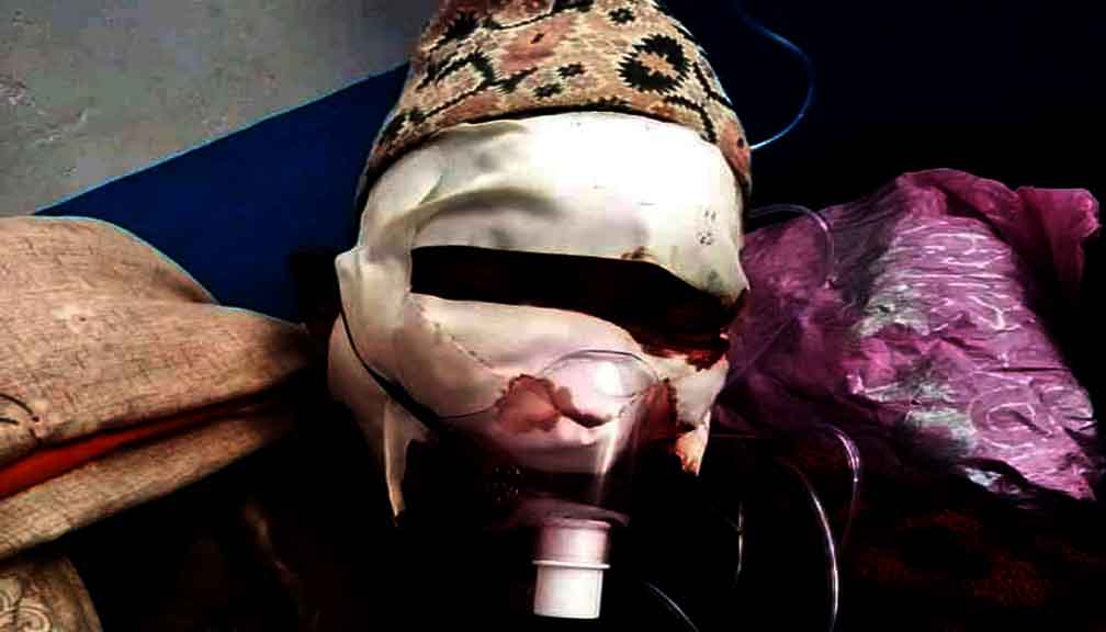 बडिमालिका ९ का बल दमाई उपचार अभावमा अलपत्र