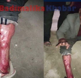 बझाङ प्रहरीको दादागिरी:हबल्दारले गरे मदिरा सेवन गरी बुद्धालाई बिच सडकमै लाठी चार्ज