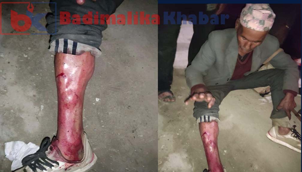 बझाङ प्रहरीको दादागिरी:हबल्दारले गरे मदिरा सेवन गरी बुद्धालाई बिच सडकमै लाठी चार्ज