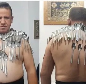 शरीरमा एकसाथ ८५ चम्चा अड्याएर विश्व किर्तिमान (भिडियोसहित)