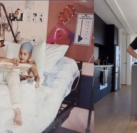 जब युवतीको शरीरमा डाक्टरले जोडिदिए उल्टो खुट्टा !