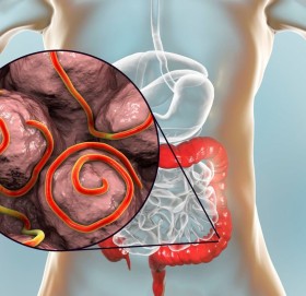जुका–चुर्नाले सताए खानुहोस् यी ६ खानेकुरा