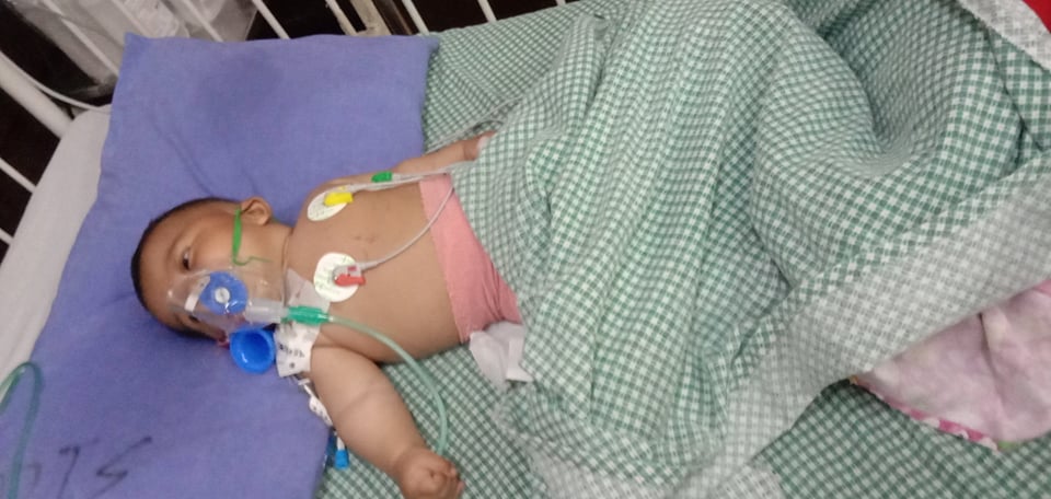 आगोले जलेको बच्चा आर्थिक अभाबमा जिवनमरणको दोसाधमा