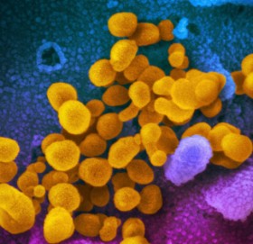 अमेरिका र फ्रान्समा देखियो कोरोनाको नयाँ भेरियन्ट ‘डेल्टाक्रोन’