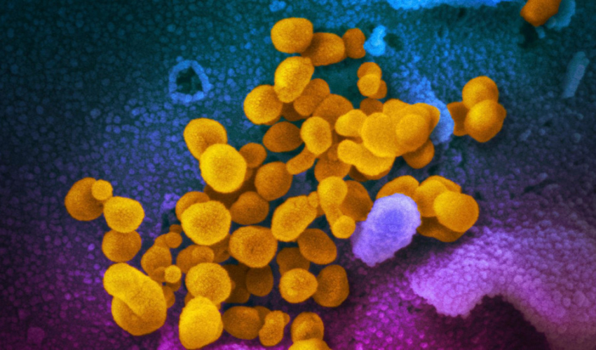अमेरिका र फ्रान्समा देखियो कोरोनाको नयाँ भेरियन्ट ‘डेल्टाक्रोन’