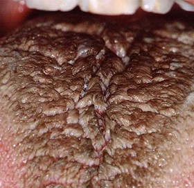 जिभ्रोमा रौं पलाएपछि…