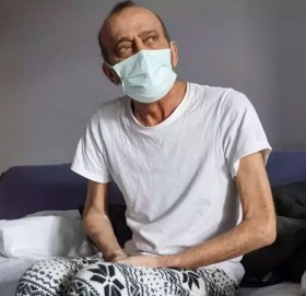 क्यान्सर पीडित मुजाफेरलाई १४ महिनामा ७८ पटक कोरोना संक्रमण