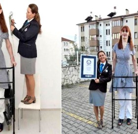 यी हुन् संसारकै अग्ली महिला, जसको नाममा छन् ३ विश्व रेकर्ड