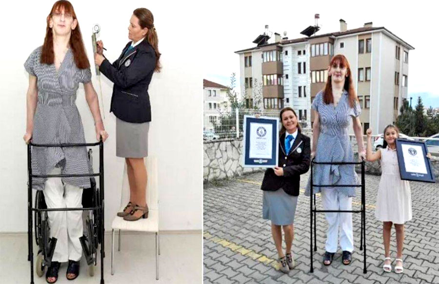 यी हुन् संसारकै अग्ली महिला, जसको नाममा छन् ३ विश्व रेकर्ड