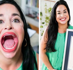 यी हुन् संसारकै ठूलो मुख भएकी महिला