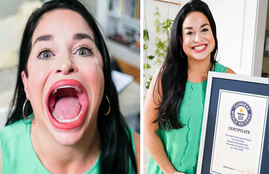 यी हुन् संसारकै ठूलो मुख भएकी महिला