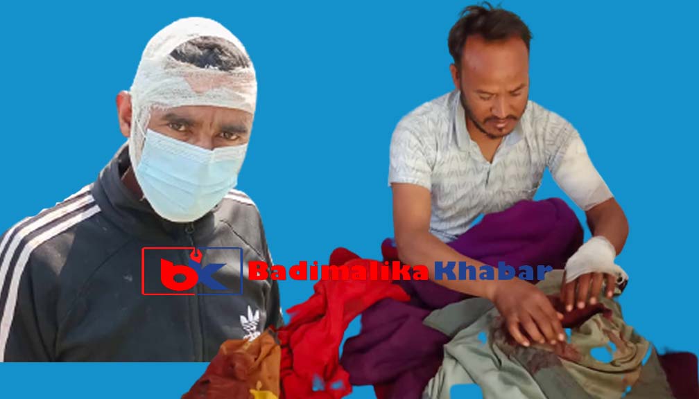 समाजवादीका सचिब रावतलाइ चक्कु हान्ने दुई जना काँग्रेस कार्यकर्ता प्रक्राउ