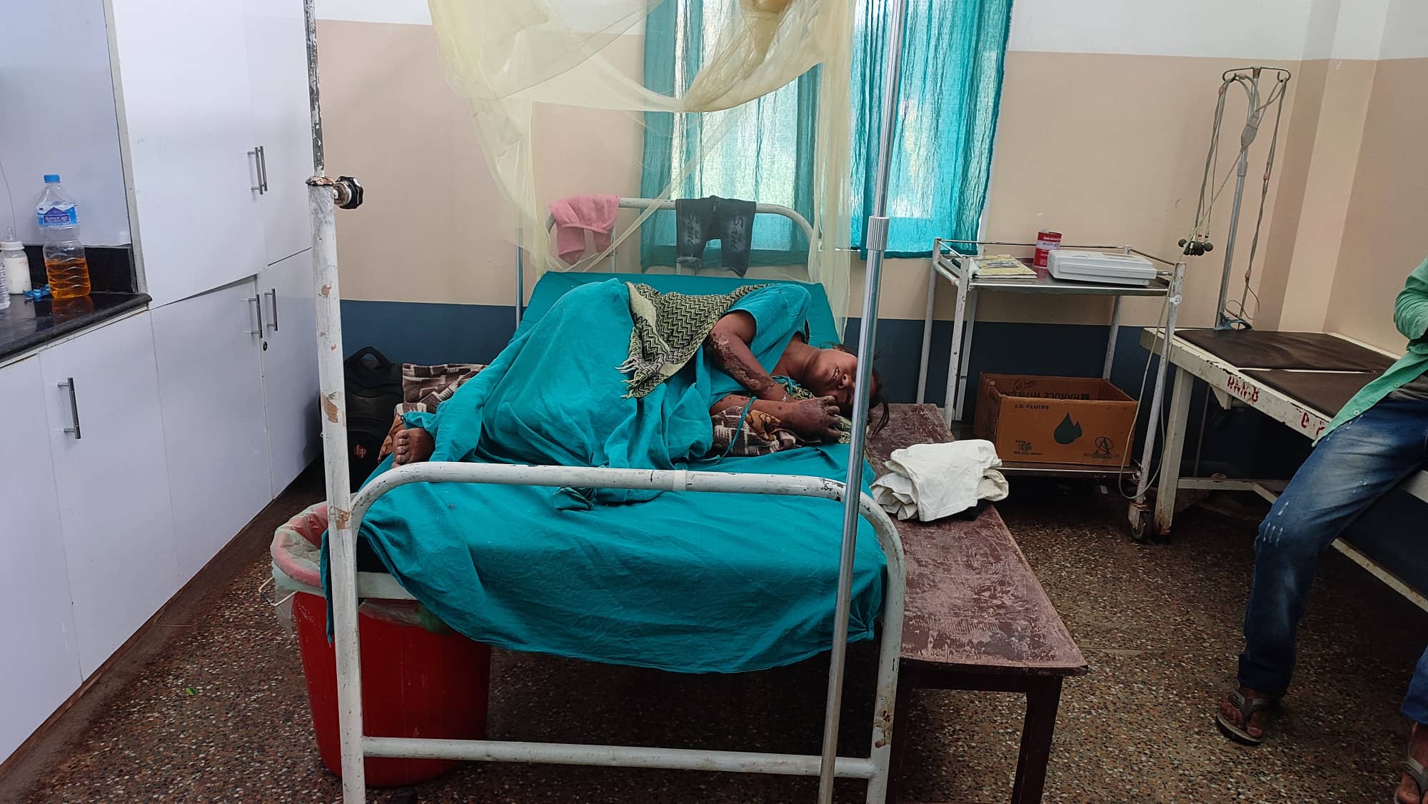 आगोले जलेकि बाजुराकी २३ बर्षयि महिलाको उपचारमा समस्या