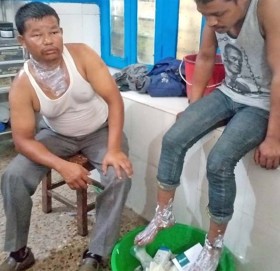 गुडिरहेको बसमा एसिड पोखिँदा ५ जना घाइते