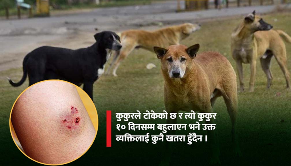 कुकुरले टोक्नासाथ रेबिज लाग्छ ?