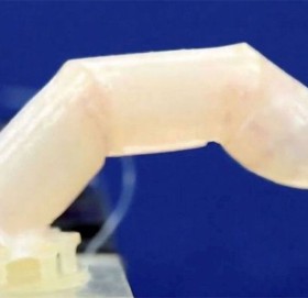 मानिसको छालाबाट बनाइयो रोबोटिक औंला, घाउ आफैं निको गराउने